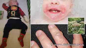 Britain's 'most dangerous plant' strikes in Somerset: Toddler is left with painful blisters across his face and hands after accidentally brushing past giant hogweed