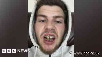 Motorcyclist gets £100k payout after horror crash