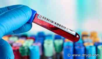 Serum Biomarkers Predict Knee OA Before Radiographic Abnormalities