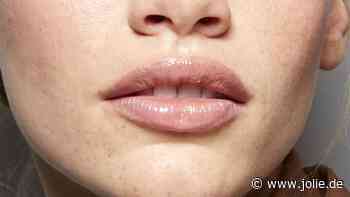Trockene Lippen: Ursachen, Tipps und die besten Pflegemittel