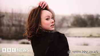 'I hope trolls listen to why alopecia is not ugly'