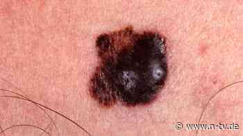 Studie zu neuem mRNA-Impfstoff: Erste Patienten werden gegen Hautkrebs geimpft