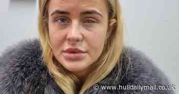 Woman blinded after getting lashes done with contact lenses in