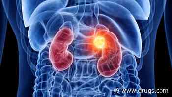 GWAS Identifies 108 Independent Risk Loci for Kidney Cancer