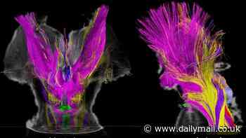 MRI scans reveal the STUNNING stages of consciousness in the brain