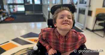 Alberta boy embraces Curly Hair Day while living with rare disorder