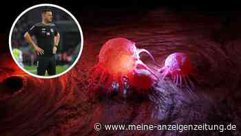 „Keine Chance auf Heilung“: Ex-Bundesliga-Star an Krebs erkrankt – Auf welche Warnzeichen Sie achten sollten