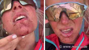 Ekelfotos nach Training: Olympiadritte blutverschmiert – absurde Paralelle zum Vorjahr