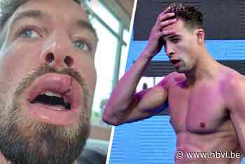 Pieter Timmers en vrouw Elle slachtoffer van zinloos geweld: “Pieters lip hing letterlijk uiteen”