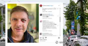 Angriffe auf politisch Aktive: Keine neue Dimension!