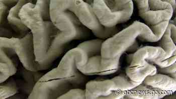 A gene long thought to just raise the risk for Alzheimer's may cause some cases