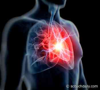 Popular ADHD Medications Like Adderall May Increase Young Adults’ Risk of Heart Damage