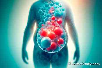 Balloon Theory in Obesity: Fat Cell Size Predicts if You Will Gain or Lose Weight