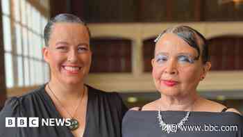 Blind dancers say ballroom contest was a dream