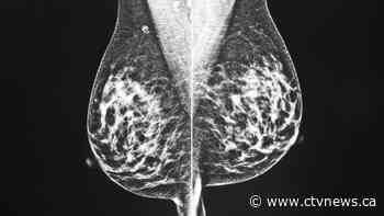 What new projections show about cancer rates, deaths in Canada