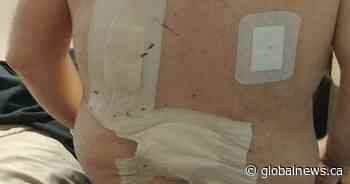 Edmonton woman speaks out after husband suffers ’20 stabs to his back’ in random attack