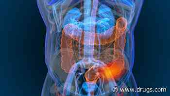 DDW: 1999 to 2020 Saw Rise in Incidence of Colorectal Cancer in People Under 45