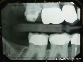 PTSD Triples Odds for Teeth Grinding, Study Finds
