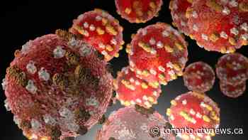 For first time in more than 10 years, child dies of measles in Ontario