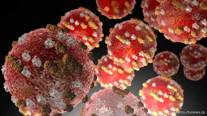 Ontario sees first measles death in more than a decade after young child dies