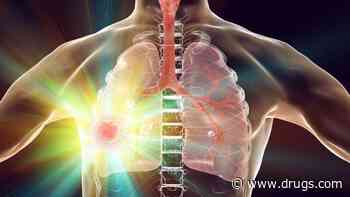 Perioperative Nivolumab Tops Chemo for Survival in Resectable Lung Cancer