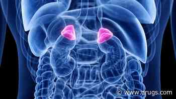 Guideline Developed for Glucocorticoid-Induced Adrenal Insufficiency