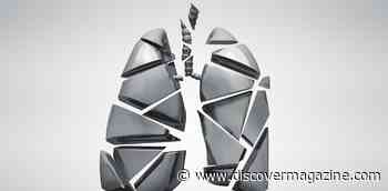 Iron Fuels Immune Cells Which Could Make Asthma Worse