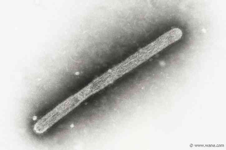 Michigan farmworker diagnosed with bird flu, becoming 2nd US case tied to dairy cows