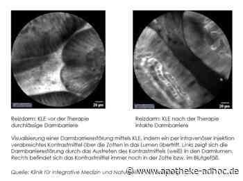 Myrrhe-Phytopharmakon kann Symptome wie Diarrhoe lindern