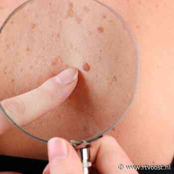 Steeds meer Overijsselaars krijgen huidkanker