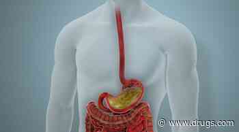 Recommendations Issued for Endoscopic Eradication Therapy in Barrett Esophagus