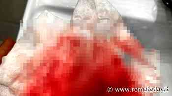 "Attenti, due corvi mi hanno ferito": paura a Roma sud