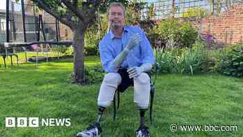 MP decides not to seek re-election after sepsis