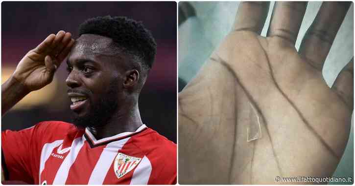 Inaki Williams gioca per due anni con un pezzo di vetro nel piede: l’incredibile storia dell’attaccante dell’Athletic Bilbao