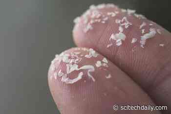 Plastic Invasion: Microplastics Found Lodged in Human and Dog Testicular Tissue