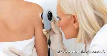 Five skin cancer symptoms to look out for as UK cases reach all-time high