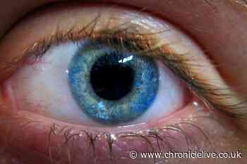 Expert reveals simple eye exercise each day can help you look ten years younger