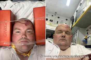 Sutton Lane, Banstead: Man seriously injured by drink-driver