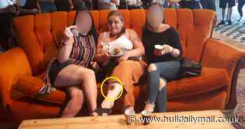 Mum left with 'crater' in her leg after doctors dismissed cancer for flaky skin for decade