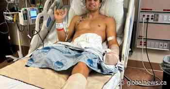 P.E.I. kiteboarder ‘lucky to be alive’ after shark attack in Turks and Caicos