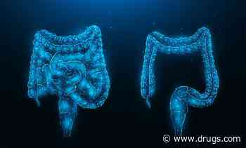 Combo Therapy Boosts Survival for Advanced Colon Cancer