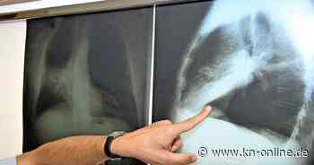 Lungenkrebs in Schleswig-Holstein: Zahl der Fälle steigt