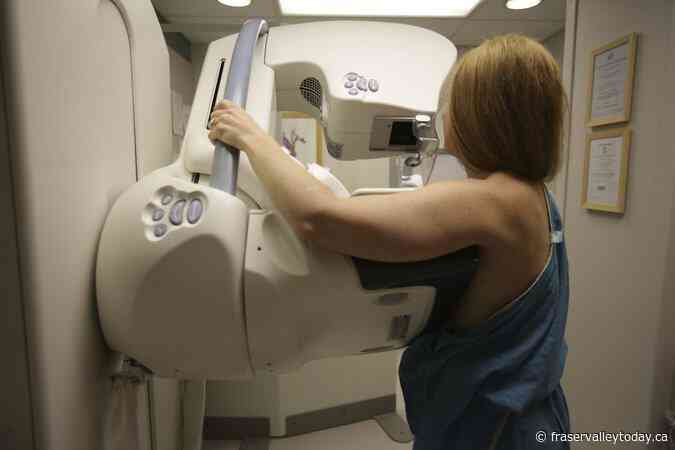 National task force not lowering age for routine breast cancer screening to 40