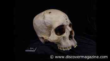 Skull Incisions Show Ancient Egyptians’ Interest in Medicine