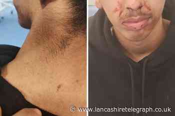 Blackburn teen punched and kicked in 'senseless' attack