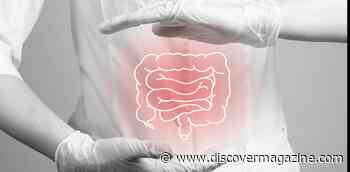 Colon Cancer Rates Are Rising In Young Americans, But Insurance Barriers Make Screening Harder