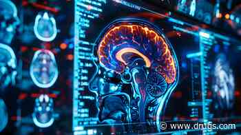 Distribution Pattern of Cerebral Aneurysms Has Remained Consistent Since 1761