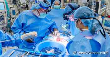 Woman Who Received Pig Kidney Transplant Has It Removed