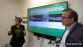 Sask. researchers studying eyes for early signs of Alzheimer's disease