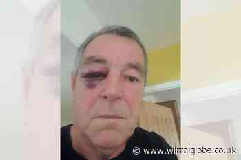 Man treated in hospital after dog attack on Leasowe Bay